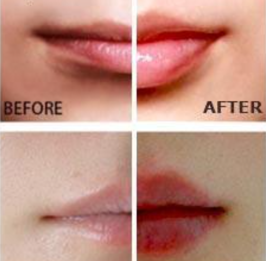 Potenciador de Labios Miracle - Volumen Natural Instantáneo